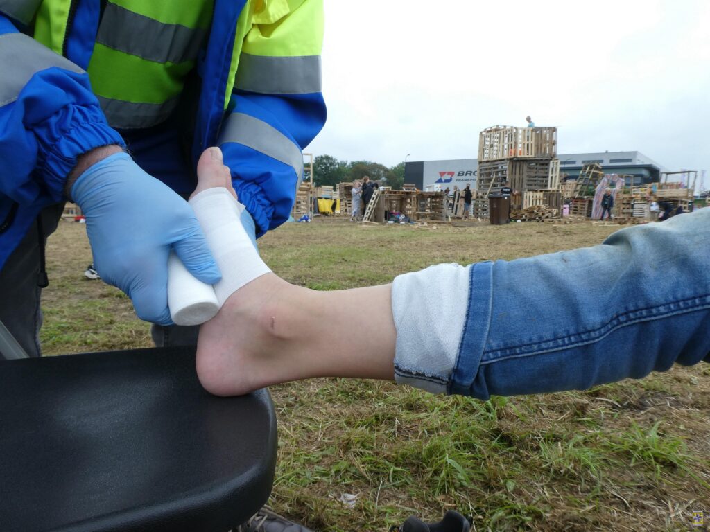 Steunverband bij verstuiking